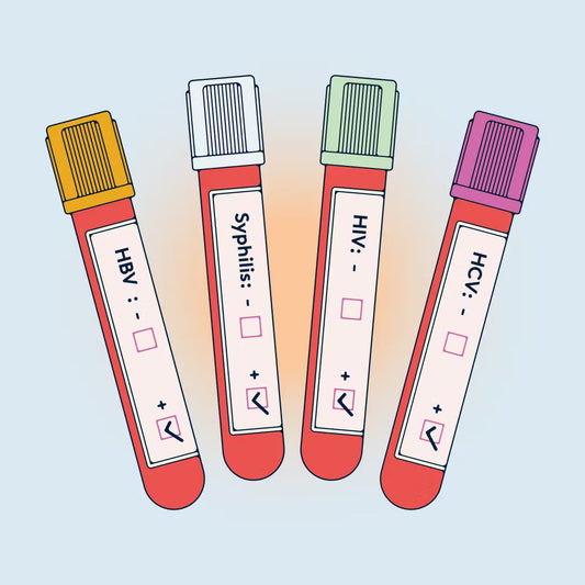 When to Test After Unprotected Sex?