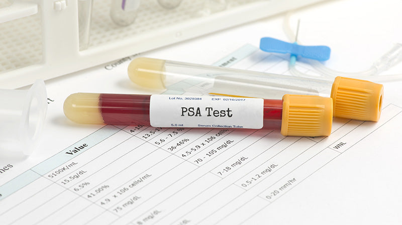 🧪 How to Use a PSA Rapid Test at Home (Step-by-Step Guide)