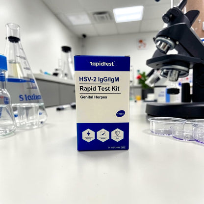 HSV-2 IgG/IgM Rapid Test Kit on a laboratory counter with lab equipment in the background